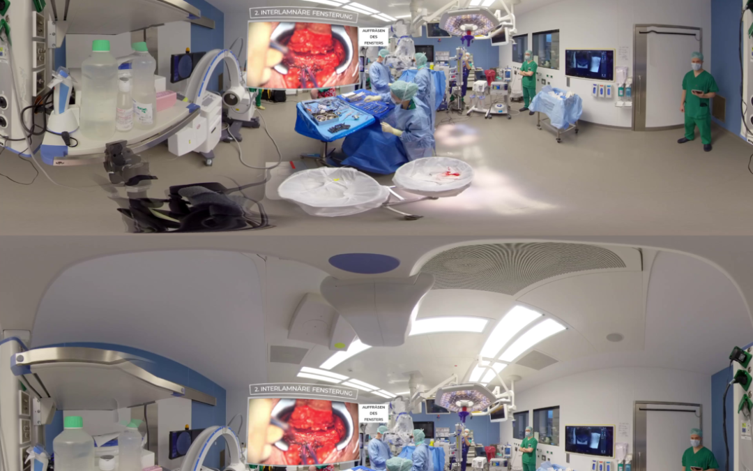 Neurosurgery